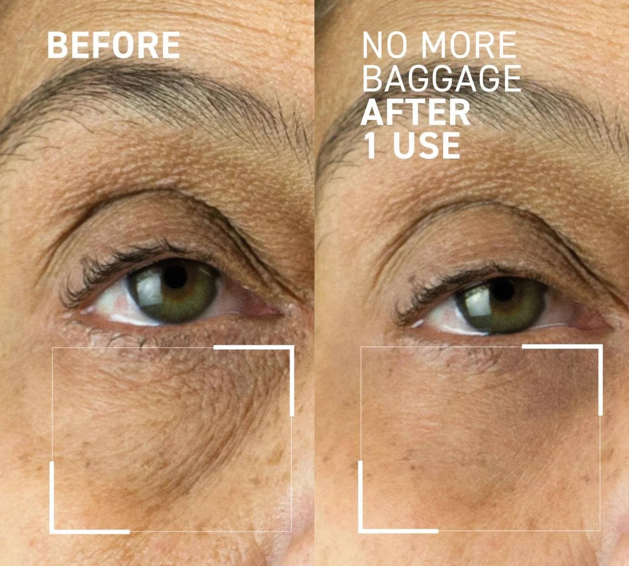 Dr. Brandt Skincare No More Baggage, A Comprehensive Guide to Reducing Under-Eye Puffiness and Dark Circles